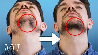 How To Fix Your Patchy Beard… Fast [upl. by Joslyn]