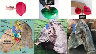 Azygos Vein amp Fissure on Radiology Xray CT amp MRI [upl. by Anerul]