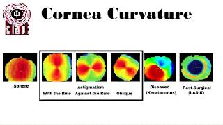 Keratometry and corneal topography [upl. by Sallad]