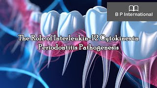 The Role of Interleukin12 Cytokines in Periodontitis Pathogenesis [upl. by Rot]