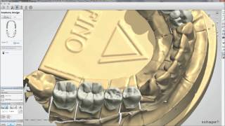 Dental System™ 2012  Smile Composer [upl. by Kizzee]