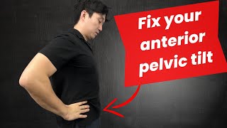 Fix anterior pelvic tilt for low back pain Here is what you need to do [upl. by Emery]