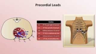 Intro to EKG Interpretation  EKG Leads [upl. by Llerehc]