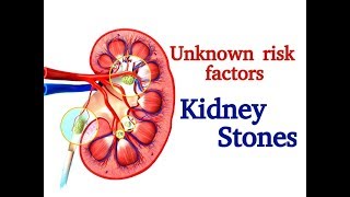 Kidney Stones Treatment in Homeopathy Dissolve Kidney Stones problems with Homeopathy [upl. by Kcirdor209]