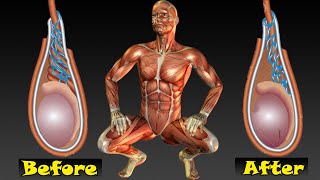 Varicocele exercise for men [upl. by Alamat]