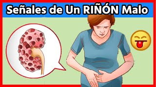 👉Los 10 PRIMEROS SÍNTOMAS de que Tu RIÑONES tienen PROBLEMAS y NO Lo Sabes [upl. by Asiram]