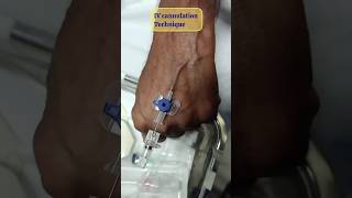 IV Cannulation technique  How to insert IV Cannula  Cannulation procedure [upl. by Tedd]