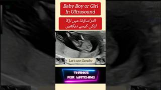 Baby Boy or Girl in Ultrasound shorts viralshorts pregnant pregnencytips ultrasoundscans [upl. by Ynottirb826]