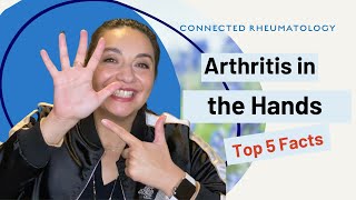 Arthritis in the HandsTop 5 Facts to know when you have hand arthritis [upl. by Nastassia828]