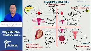 Obstetricia Hemorragia posparto  RM 2023 [upl. by Sausa521]