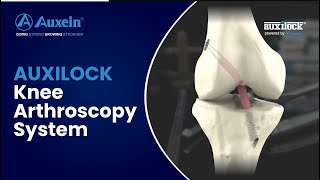 AUXILOCK Knee Arthroscopy System [upl. by Nurav]