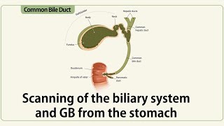 Scanning of the biliary system from the stomach [upl. by Ial652]