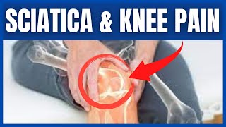 Does Sciatica Cause Knee Pain [upl. by Stalker]