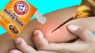 14 EFFECTIVE Home Remedies For Bee Stings  Natural Bee Sting Treatment [upl. by Nocaed]