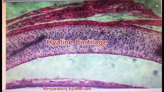 Histology of Trachea [upl. by Maire]