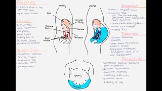 Ascites  Causes Diagnostic Algorithm Treatment Complications [upl. by Irami]