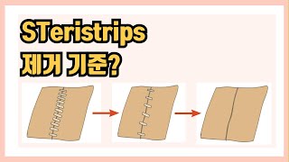 스테리스트립 언제 떼도 되는거에요 스테리스트립 steristrips 신규간호사 간호사 간호조무사 간호학과 간호 [upl. by Kimball]