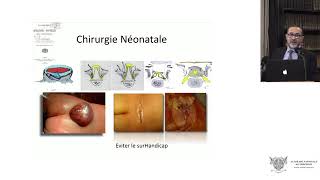 Le traitement chirurgical prénatal endoscopique du myéloméningocèle [upl. by Yaresed]