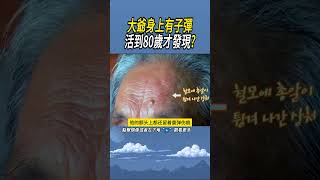 大爺身上有子彈，活到80歲才發現 實驗 科普 [upl. by Ferri]