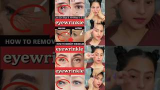 🤯👀♨️ 7day wrinkles free eyesantiaging eyes wrinkleseyebagssimple easy try it daily♨️📛👀shorts [upl. by Balcer180]