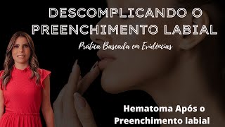 Hematoma após o Preenchimento labial Quando é normal [upl. by Llehsyt]