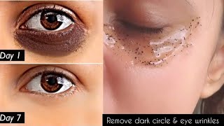 How to remove under eye wrinkles under eye bags  puffy eyes and dark circles [upl. by Tory]