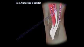 Pes Anserine Bursitis  knee pain  Everything You Need To Know  Dr Nabil Ebraheim [upl. by Jolyn]