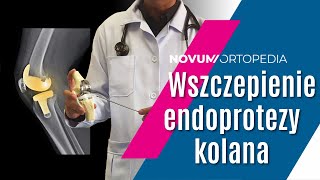 Obustronna ALLOPLASTYKA KOLAN  zabieg WSZCZEPIENIA ENDOPROTEZY stawu kolanowego  Novum Ortopedia [upl. by Champagne]