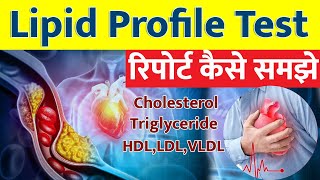 Lipid profile test in Hindi I Lipid profile Test Report कैसे समझे I [upl. by Rramal]