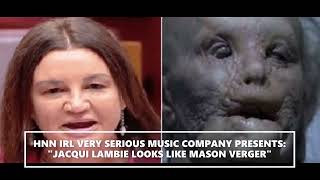 quotJacqui Lambies Got A Fuked Up Facequot Looks Like Mason Verger [upl. by Niboc]