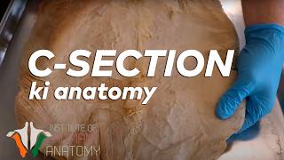 CSection ki Anatomy in Hindi [upl. by Atteuqram]