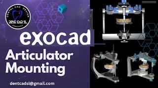 exocad digital model mounting with articulator [upl. by Claribel]