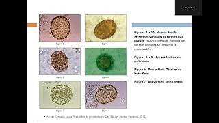 Enteroparasitismo por nematodos I [upl. by Anir]