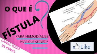 FÍSTULA PARA HEMODIÁLISE O QUE É  PARA QUE SERVE [upl. by Vickie]