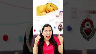 ¿Qué es la Ictericia neonatal shortsyoutube [upl. by Cowden]