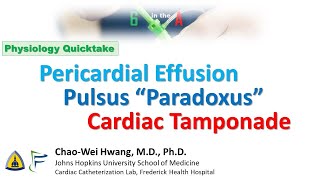 Pulsus Paradoxus Pericardial Effusion Cardiac Tamponade [upl. by Nirat778]