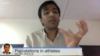 Palpitations in athletes  why and what to do about them [upl. by Dolley]