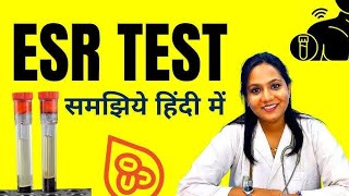 ESR TEST IN HINDI youtube youtbevideos video laboratory shortvideos doctor [upl. by Havens574]