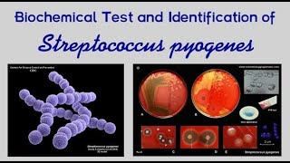 Pharyngitis Part 2 Bacterial Pharyngitis Streptococcus Pyogenes [upl. by Gean]