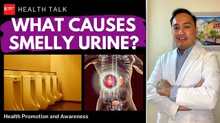 What causes smelly urine Ano ang dahilan bakit kakaibang amoy ang ating ihi [upl. by Aneloc]