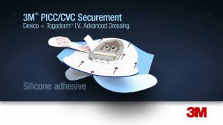 3M™ PICCCVC Securement Device  Tegaderm™ IV Advanced Dressing Application and Removal [upl. by Mclaurin]