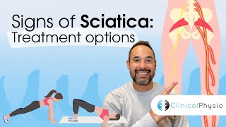 Sciatica Treatment Options  Expert Physio Guide [upl. by Curt450]