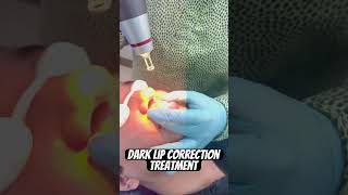 Dark lip correction treatment Dr Mona Swamy [upl. by Ailgna534]