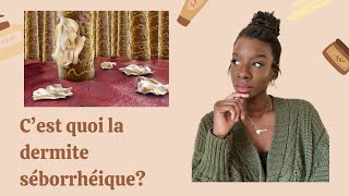 Tout savoir sur la dermite séborrhéique Les causes comment traiter [upl. by Annoj935]