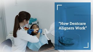 How do DentCare Aligners Work [upl. by Wrennie]