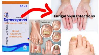 Dermosporin solution for fungal infections uses in urdu [upl. by Peder238]