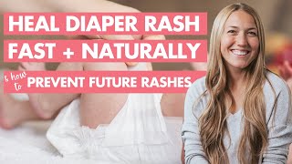 FAST  NATURAL Diaper Rash Treatment Every Parent Should Know [upl. by Zadoc]