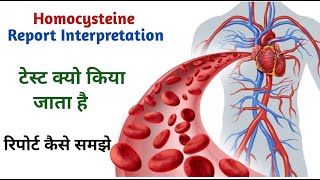 homocysteine blood test report II Homocysteine blood test [upl. by Eiramlatsyrc]