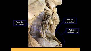 Mediastinum PPT Slide Presentation [upl. by Nyleda]