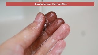 How to Remove Dye from Skin After Dying Hair – Home Remedies [upl. by Serrell275]